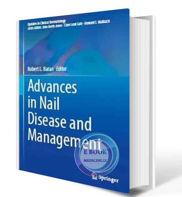 دانلود کتابAdvances in Nail Disease and Management (Updates in Clinical Dermatology) 2021  (Original PDF)